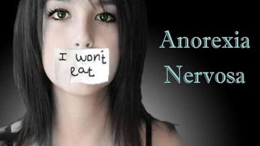 Anorexia nervosa